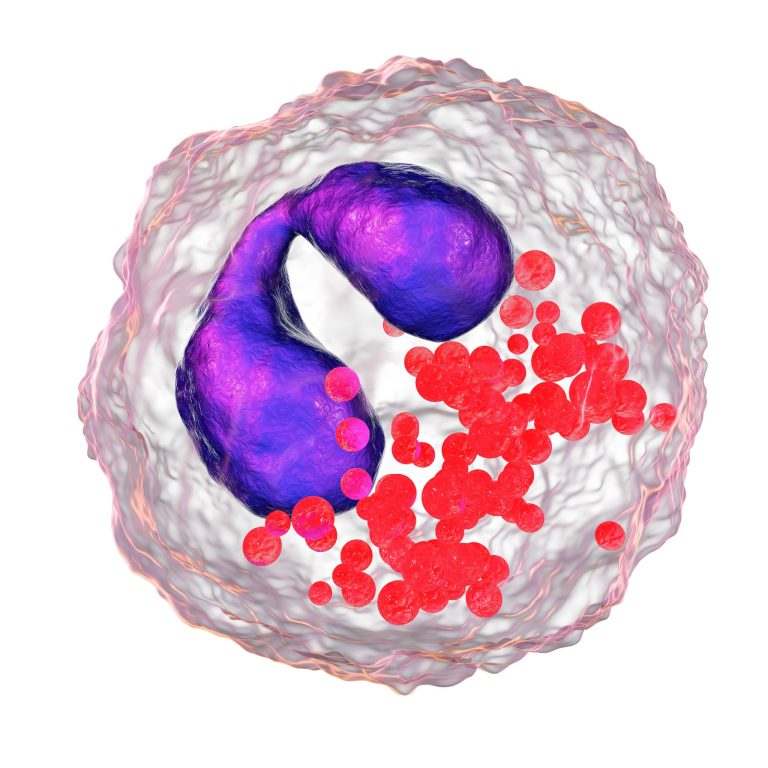 Hyperéosinophilie : causes, diagnostic et traitements