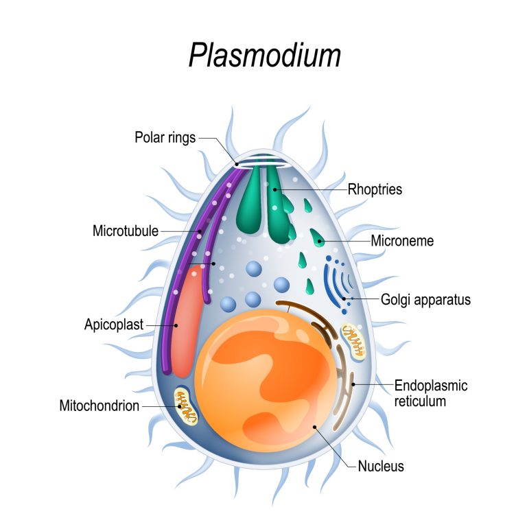 Traitement et surveillance d’une forme grave de paludisme à plasmodium falciparum