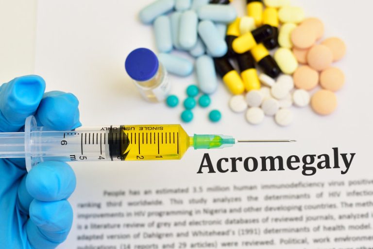 ACROMÉGALIE : causes, symptômes, traitements et prévention