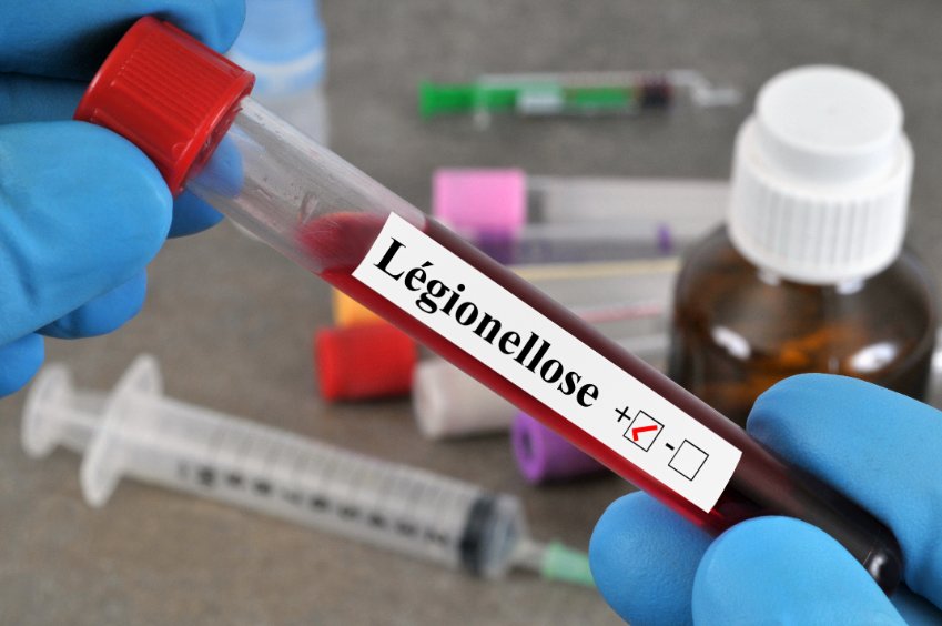 Légionellose : formes, causes, symptômes, traitement