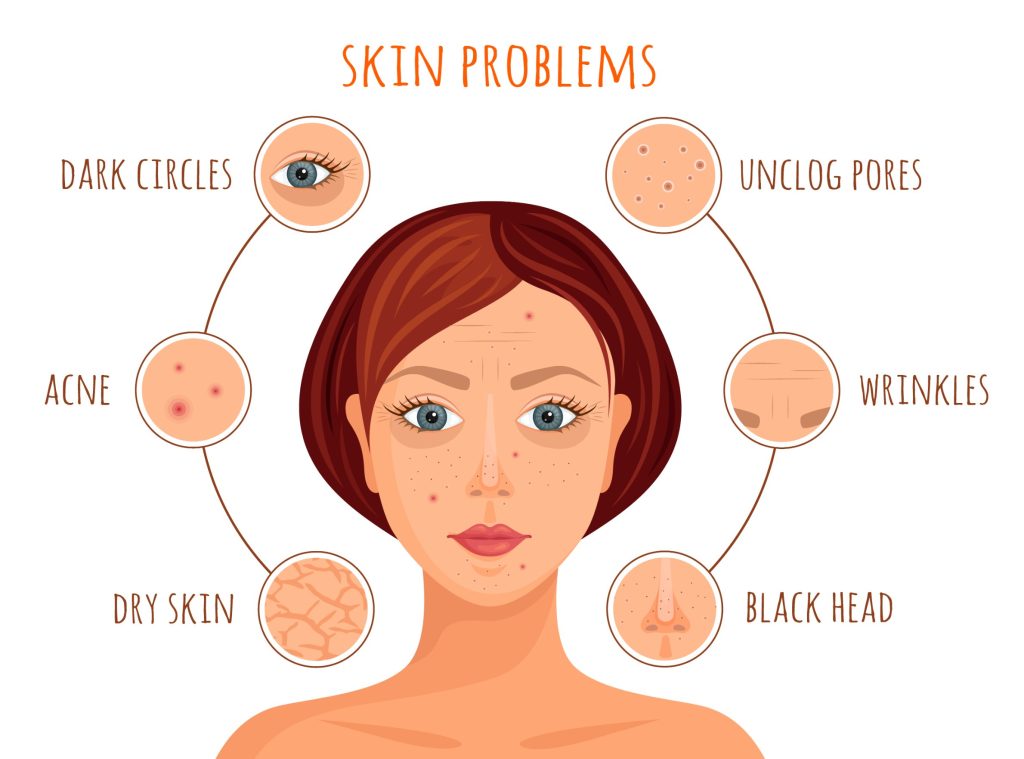 Dermatologie: quelles sont les maladies de peau? 114963778 M 1024x759