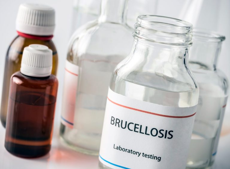 Brucellose : causes, symptômes et traitements