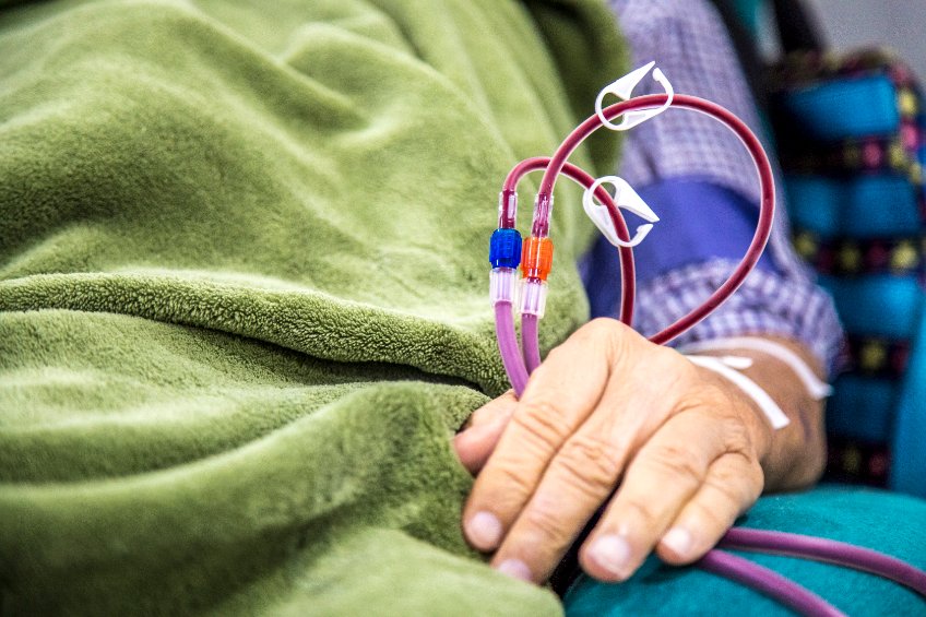 NEPHROHUS : causes, symptômes, diagnostics, traitements