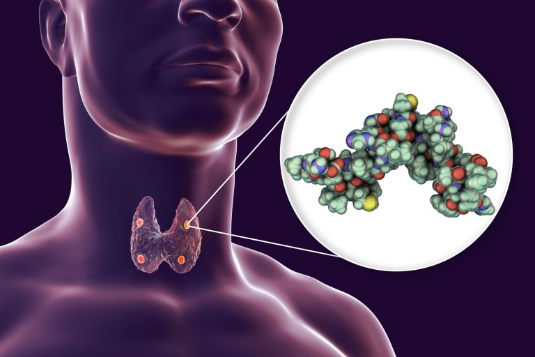 Hyperparathyroïdie : causes, symptômes et traitements
