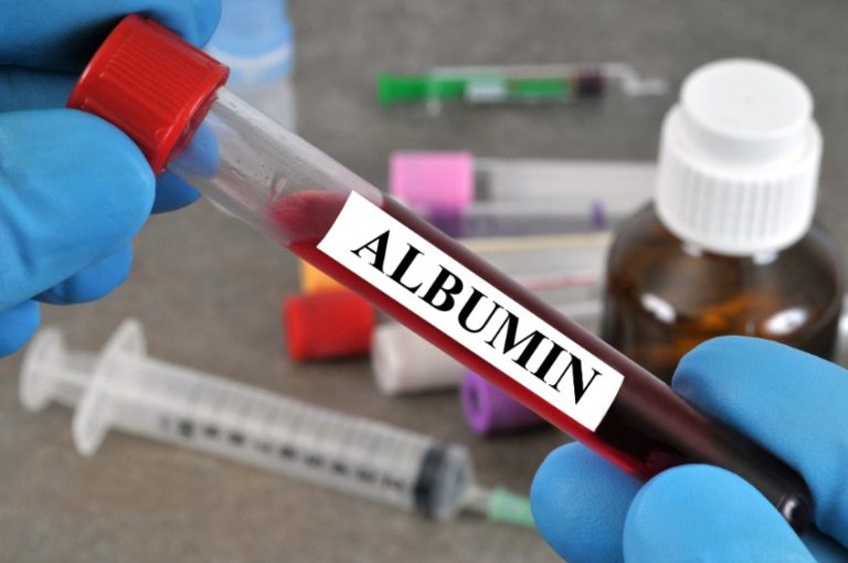 LA MICROALBUMINURIE : But, Procédure, Résultat, Traitements