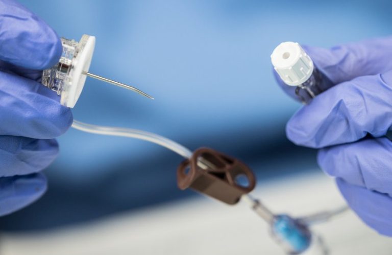 La perfusion sous-cutanée : description, indication et modalités d’administration