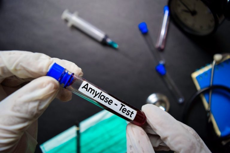 Augmentation de l’amylasémie : causes, analyses et traitements