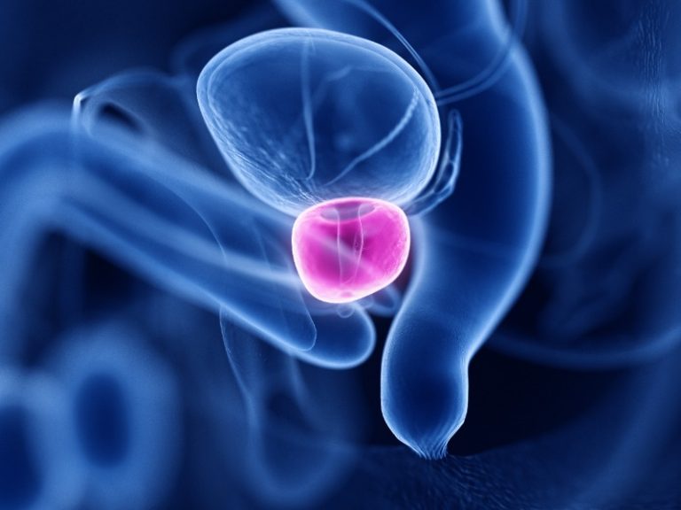 Optimisation de la santé de la prostate : implications de quelques études