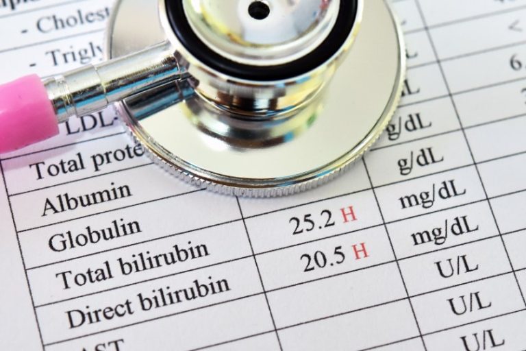 Hyperbilirubinémie : causes, symptômes et traitements