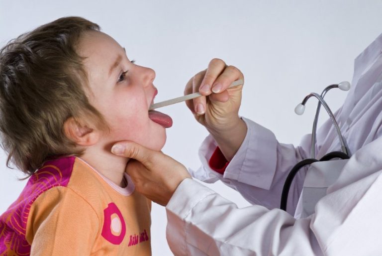 Adénopathies cervicales de l’enfant : causes, symptômes, diagnostic, traitement