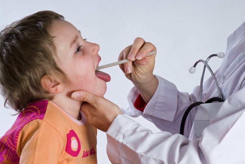Adénopathies cervicales de l'enfant : causes, symptômes ...