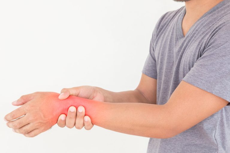 Algodystrophie réflexe : causes, symptômes et solutions