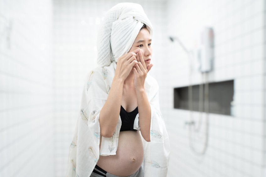 Acné de grossesse : symptômes, causes, diagnostic, traitement, prévention