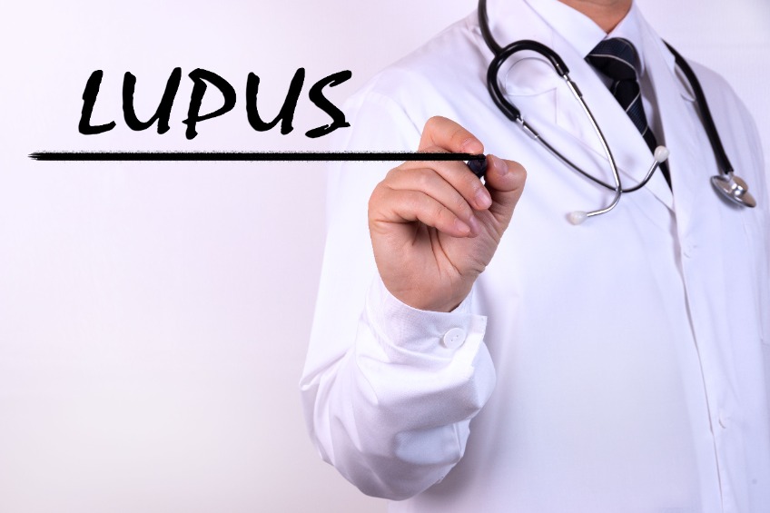 Lupus érythémateux disséminé : causes, symptômes, traitement 142697355 S