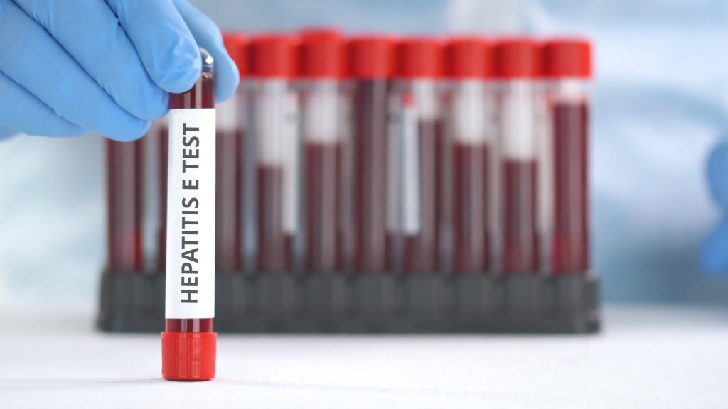 Hépatite E : causes, symptômes et traitements 142764337 M 1024x576