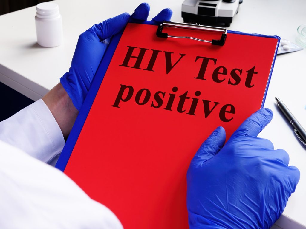 VIH/SIDA : Mode de contamination, symptômes et traitements