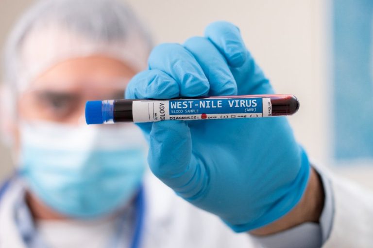 Virus du Nil Occidental : manifestations, diagnostic et prévention