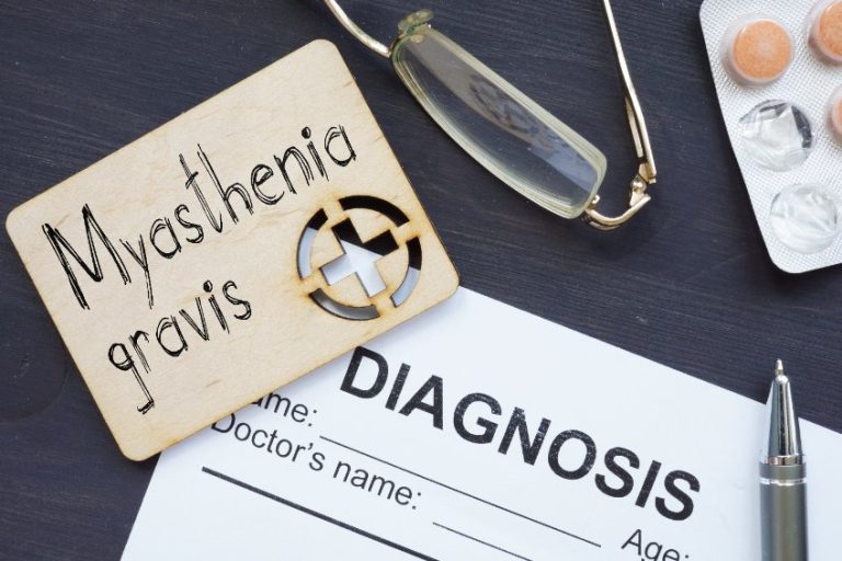 Myasthénie : causes, symptômes, évolution, diagnostic et traitements