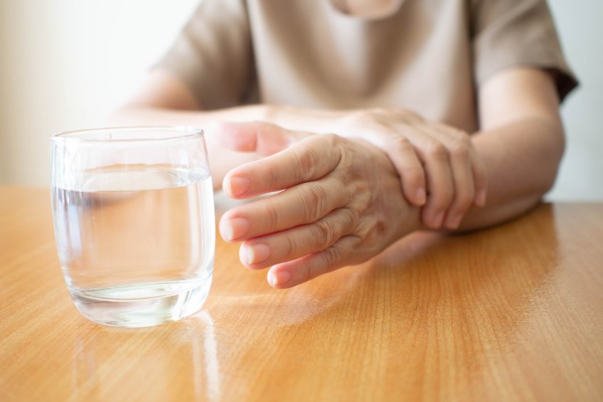 Les faux Parkinson : généralités, typologie, caractéristiques 148063139 S