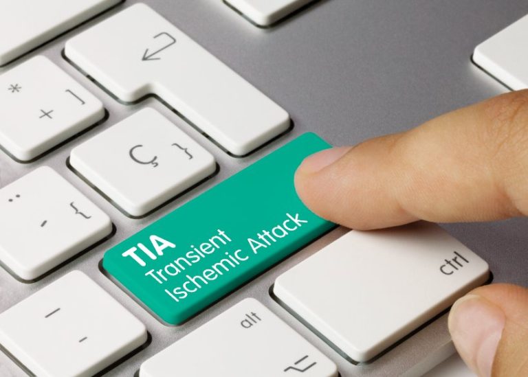 Accident Ischémique Transitoire (AIT) : causes, symptômes, diagnostic, traitements