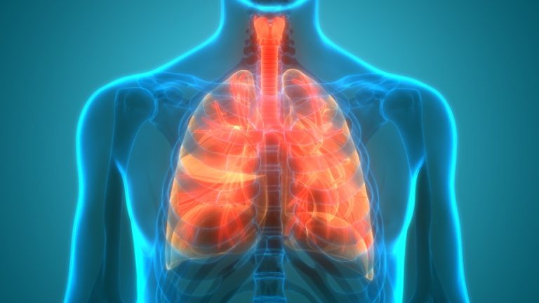 La mucoviscidose : Physiopathologie, Causes, Symptômes, Traitement
