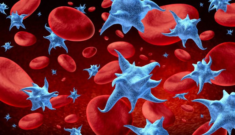 Les thrombopénies : étiologies