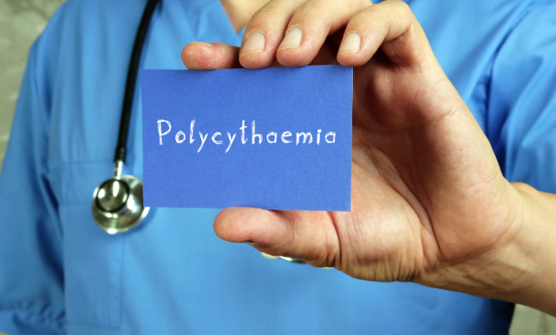 Les polyglobulies : classification, causes, symptômes, traitement ...