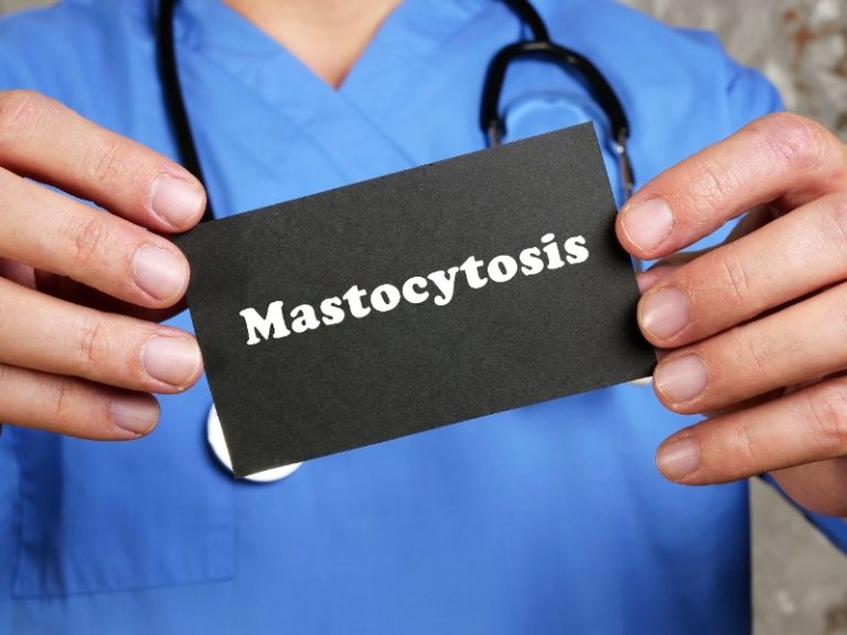 Mastocytose systémique : causes, symptômes, traitement