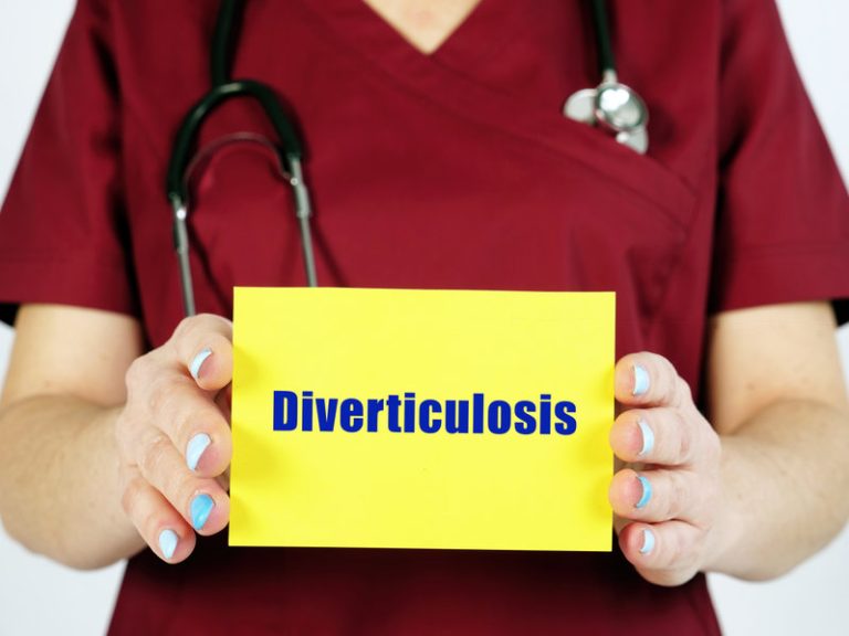Sigmoïdite diverticulite aiguë : causes, symptômes, diagnostic, solutions
