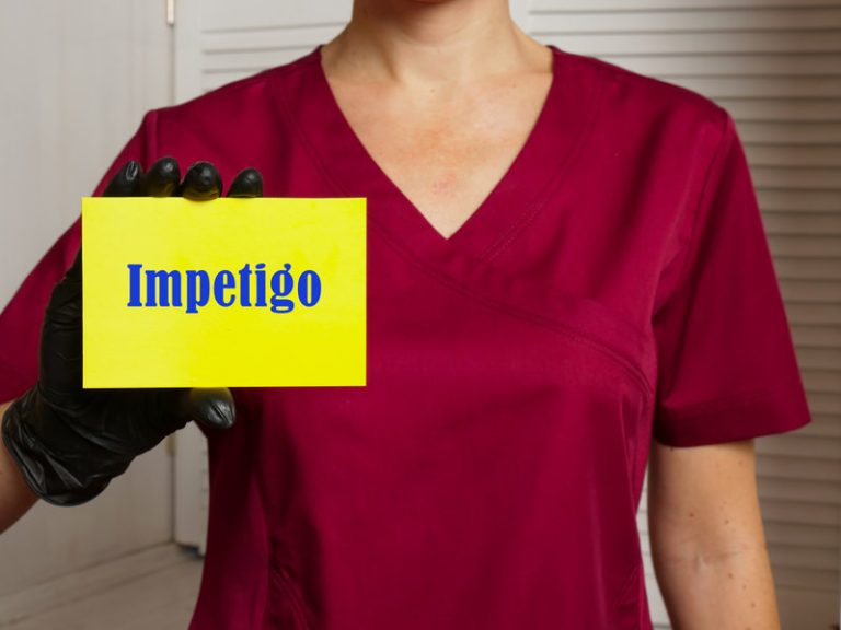 Impétigo : causes, symptômes, diagnostic, traitement et prévention
