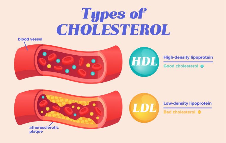 Que savoir sur la lipoprotéine (A) ?