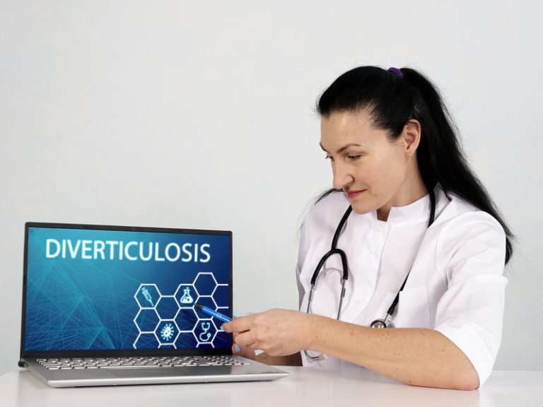 Diverticulose colique : causes, symptômes, traitements et moyens de prévention