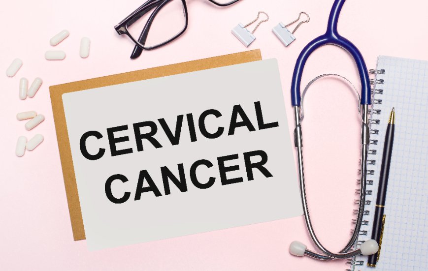 Cancer du col de l’utérus : Causes, symptômes, diagnostic, traitement 168712375 S