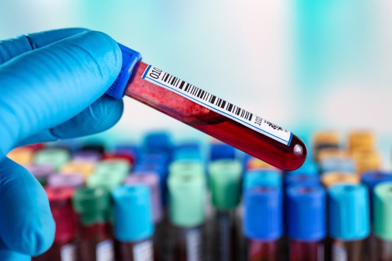 Ionogramme sanguin : quand et comment faire le test ?