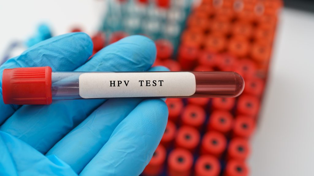 Le papillomavirus (HPV) : causes, symptômes et traitements