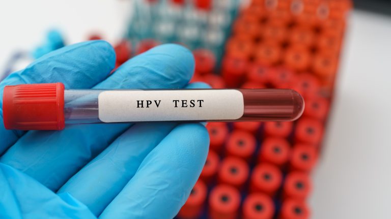 Le papillomavirus (HPV) : causes, symptômes et traitements