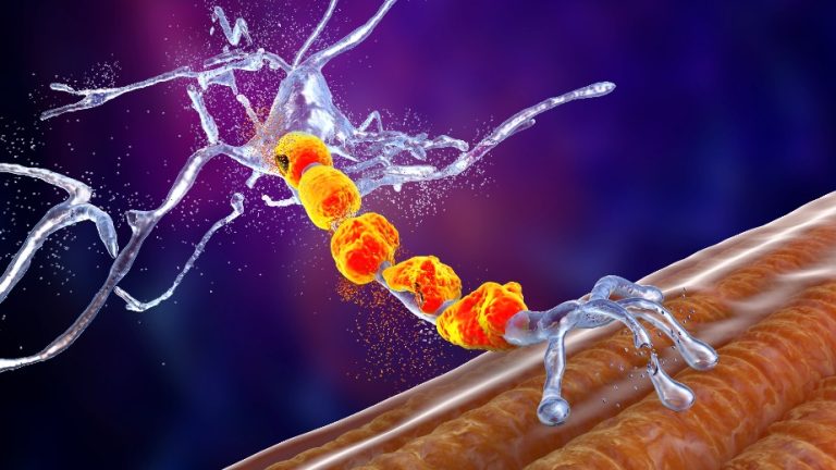 La maladie de Von Willebrand : Causes, symptômes et diagnostics