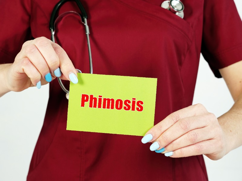 Phimosis : causes, symptômes, complications et traitements - esculape