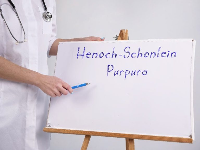 Purpura : causes, symptômes, diagnostic, traitements et prévention