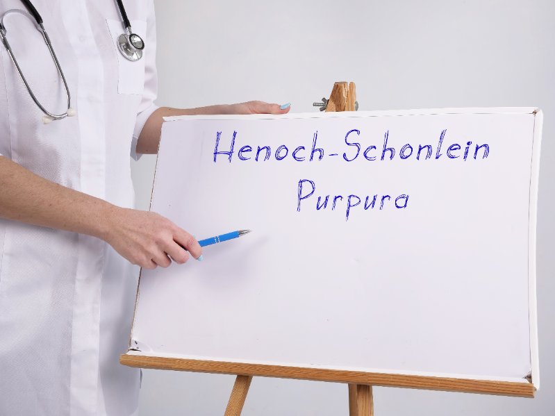 Purpura : causes, symptômes, diagnostic, traitements et prévention 173956958 S