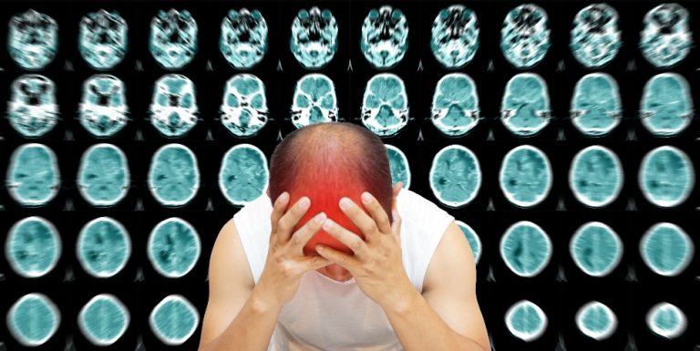 Les méningites : causes, symptômes et traitements