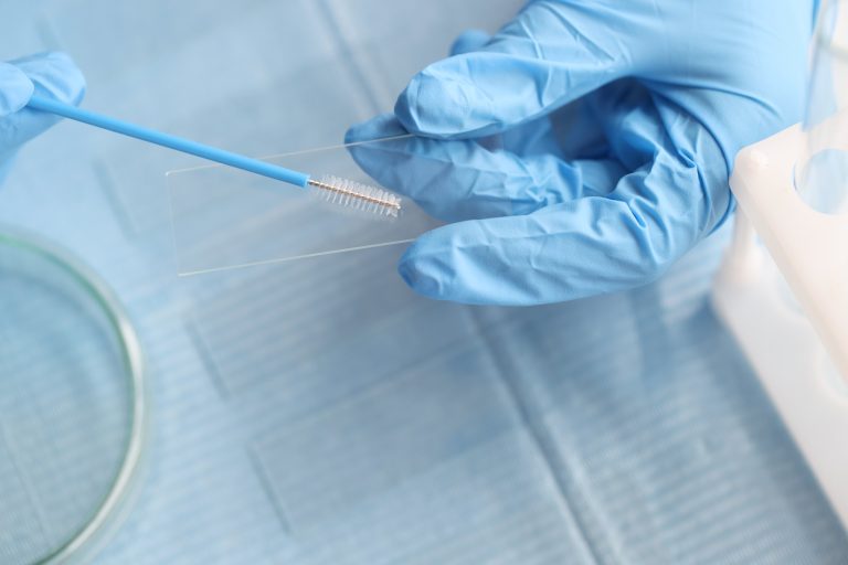 Frottis cervico-vaginal : quand et comment le faire ?