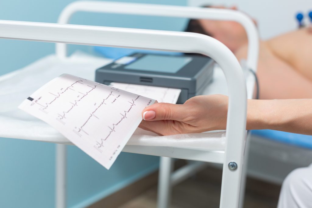 TACHYCARDIE : causes et traitements du battement rapide du cœur
