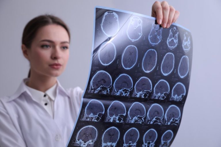 La sclérose en plaques : Causes, symptômes, diagnostic et thérapie