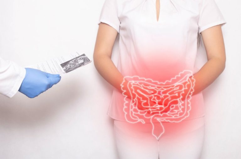 La maladie de Crohn : causes, symptômes, diagnostic et traitement 