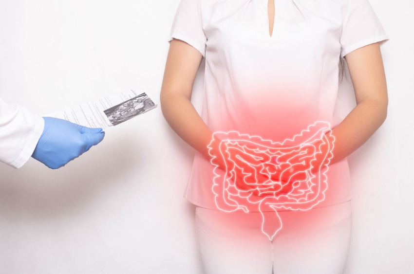 La maladie de Crohn : causes, symptômes, diagnostic et traitement