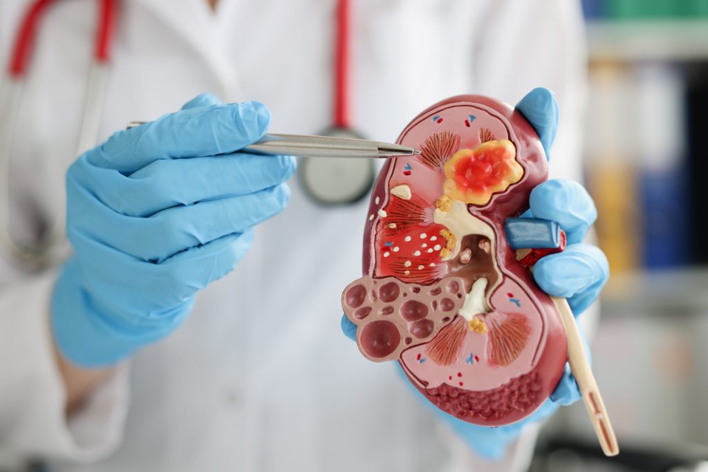 Urologie – Néphrologie: deux spécialités des reins