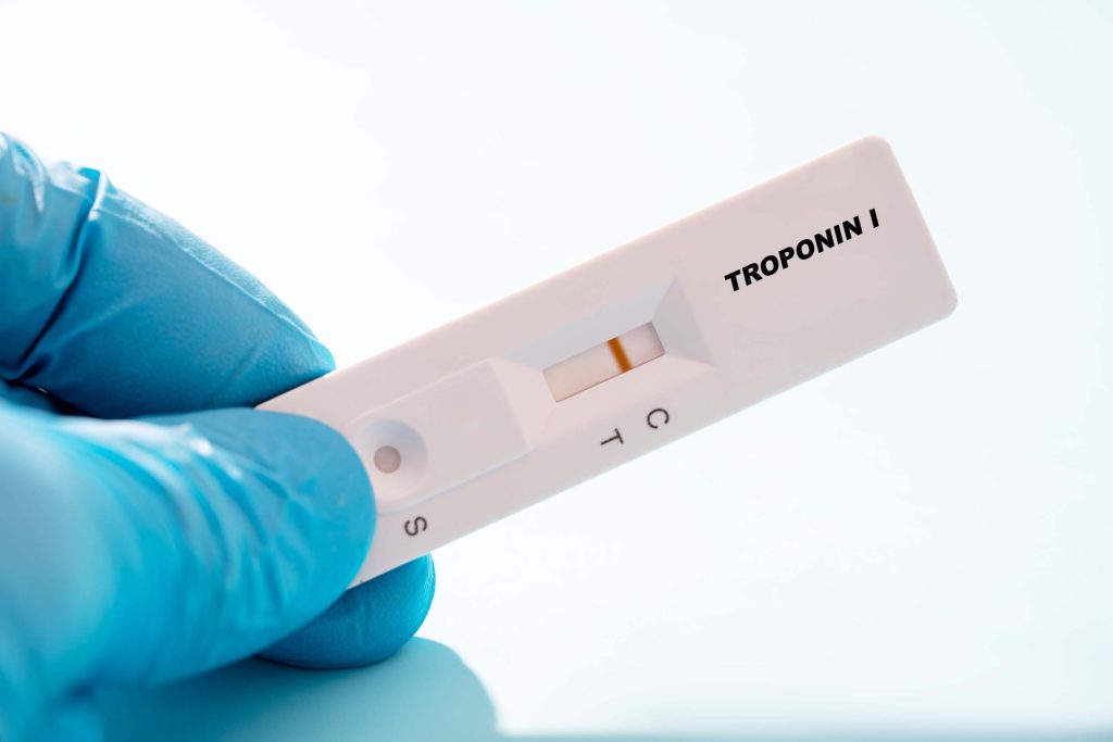 Troponine I cardiaque : comment fonctionne-t-elle ?