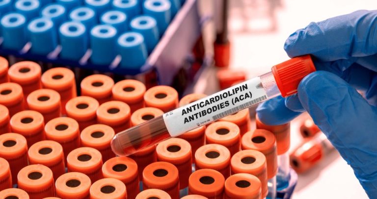 Les anticorps anti-cardiolipine : Présentation et affections associées