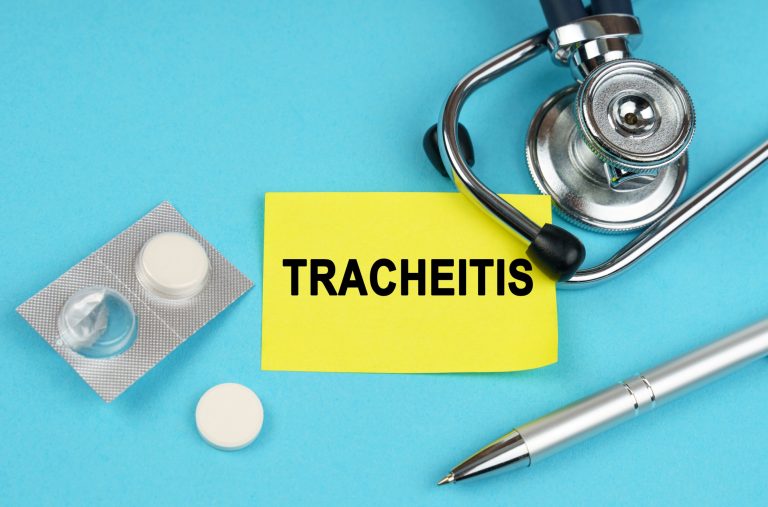 Trachéite : causes, diagnostic et traitements